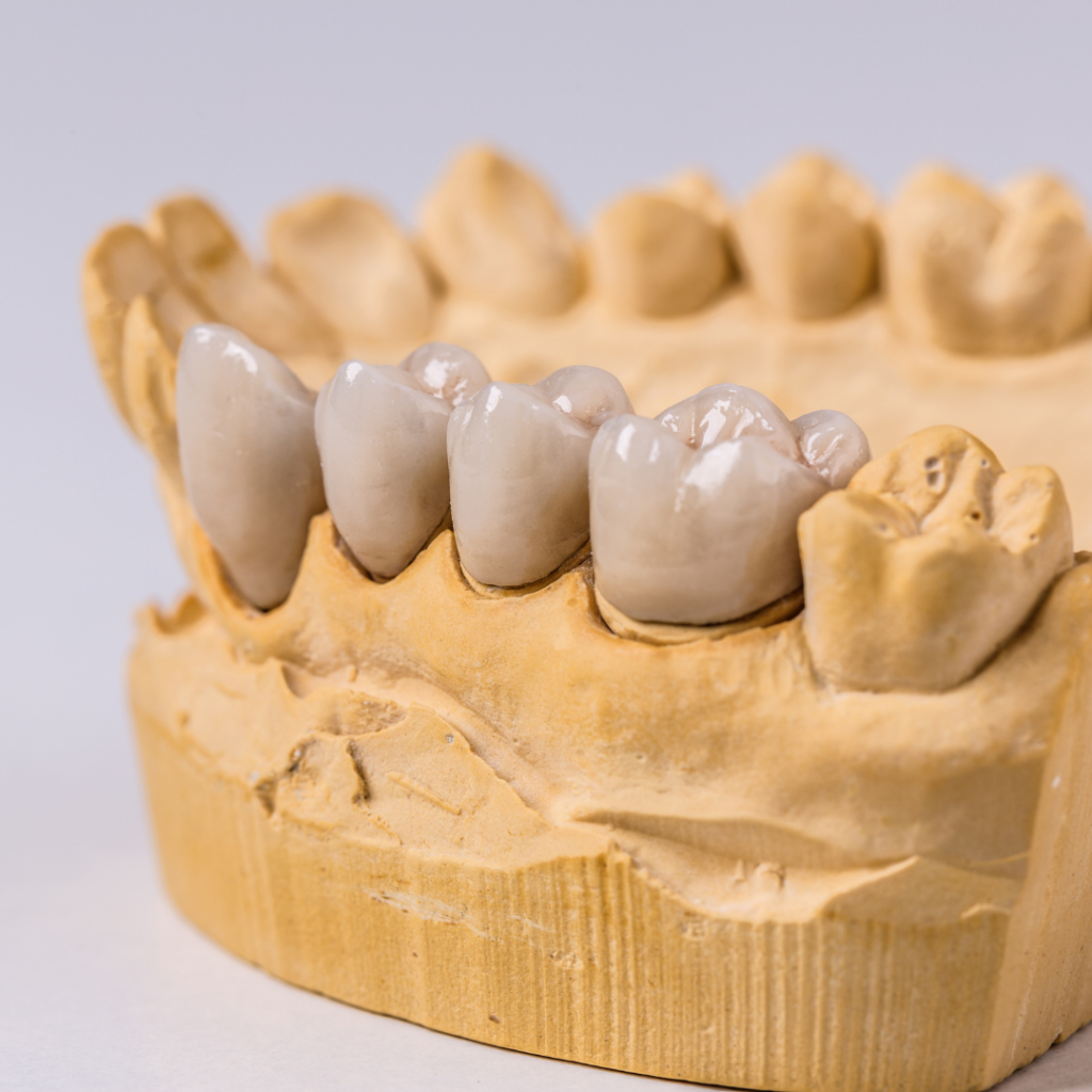 Conheça todos os tipos de prótese dentária