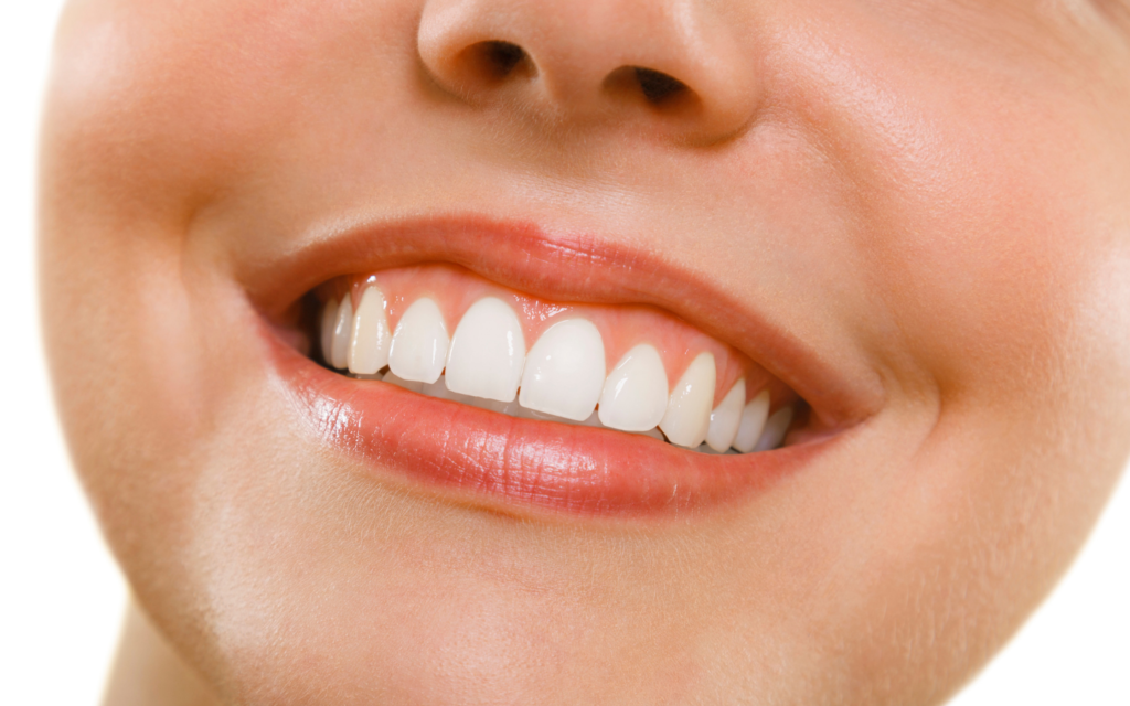 Resina composta: Qual a sua utilidade no tratamento dentário?